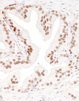 Goat DBC1/p30 DBC Antibody
