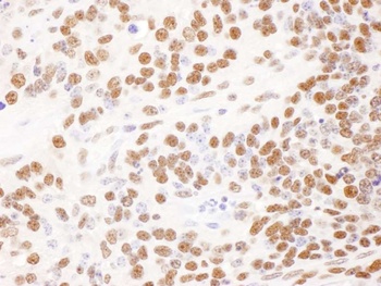 Goat DBC1/p30 DBC Antibody