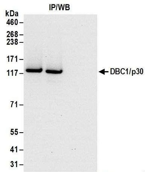Goat DBC1/p30 DBC Antibody