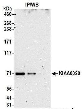 Rabbit KIAA0020 Antibody