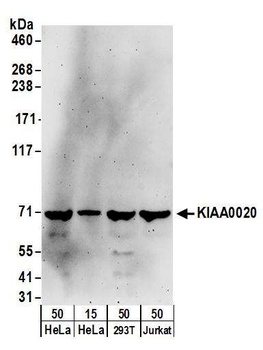 Rabbit KIAA0020 Antibody