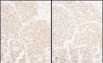 Rabbit PSMD4 Antibody