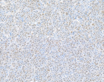 Rabbit PSMD1 Antibody