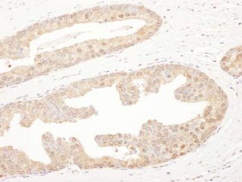 Rabbit PSMA6 Antibody