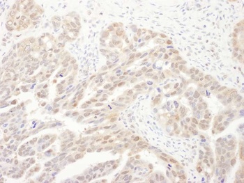 Rabbit PSMA6 Antibody
