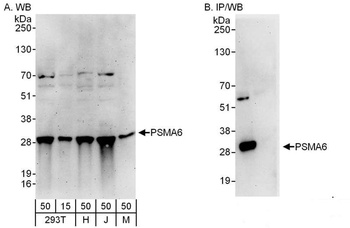 Rabbit PSMA6 Antibody