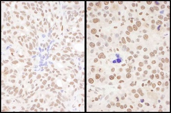 Rabbit SRSF7 Antibody