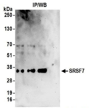 Rabbit SRSF7 Antibody