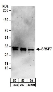 Rabbit SRSF7 Antibody