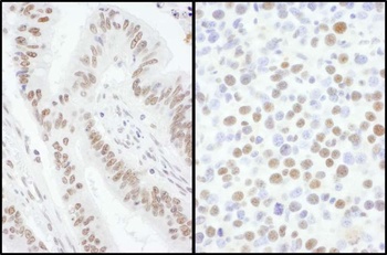 Rabbit SRSF7 Antibody