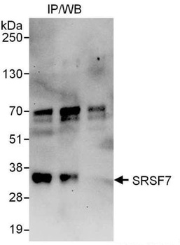 Rabbit SRSF7 Antibody
