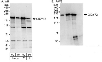 Rabbit GIGYF2 Antibody