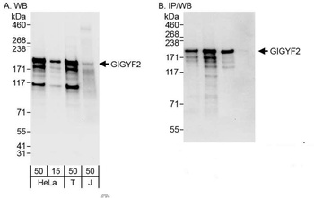 Rabbit GIGYF2 Antibody