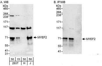 Rabbit MYEF2 Antibody