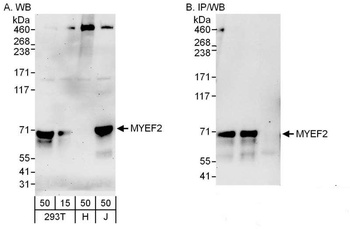 Rabbit MYEF2 Antibody