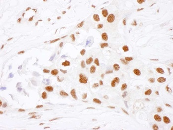 Rabbit NF90 Antibody