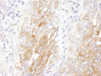 Rabbit LIN28B Antibody