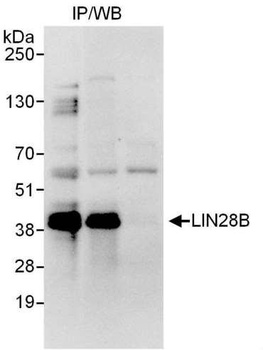 Rabbit LIN28B Antibody
