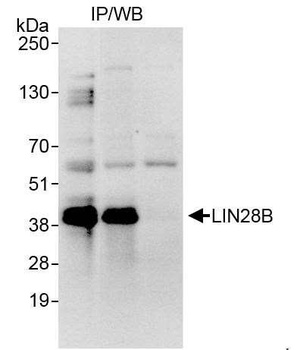 Rabbit LIN28B Antibody
