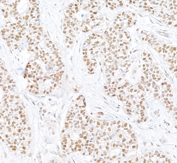 Rabbit PARN Antibody