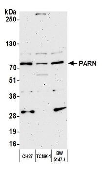Rabbit PARN Antibody