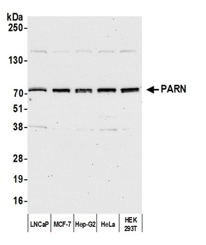 Rabbit PARN Antibody