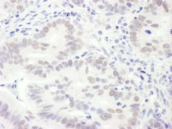 Rabbit EDD1 Antibody