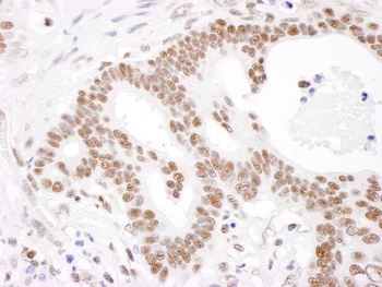 Rabbit PABPN1 Antibody