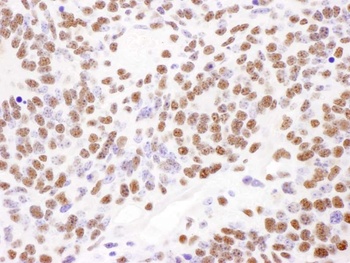 Rabbit PABPN1 Antibody