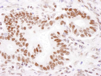 Rabbit PABPN1 Antibody