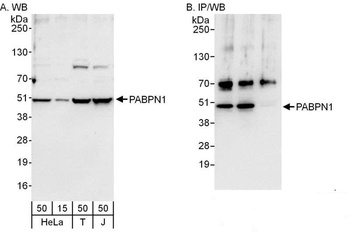 Rabbit PABPN1 Antibody