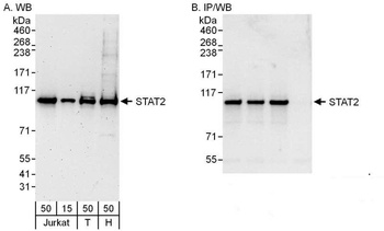 Rabbit STAT2 Antibody