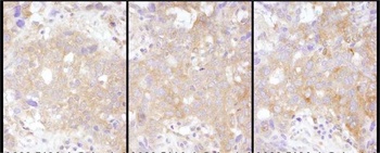 Rabbit STAT2 Antibody