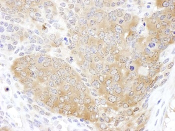 Rabbit CCT5 Antibody