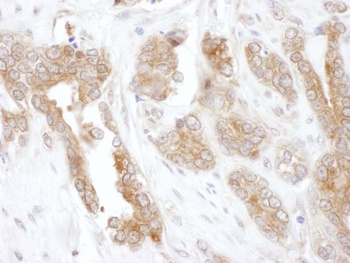 Rabbit CCT5 Antibody