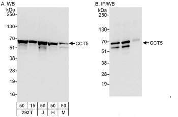 Rabbit CCT5 Antibody