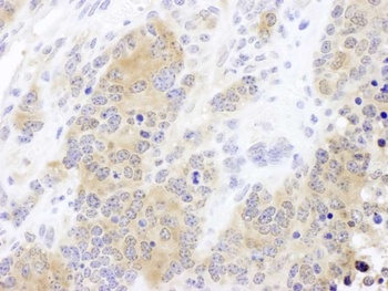 Rabbit CCT2 Antibody