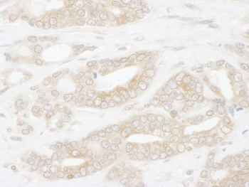 Rabbit CCT2 Antibody