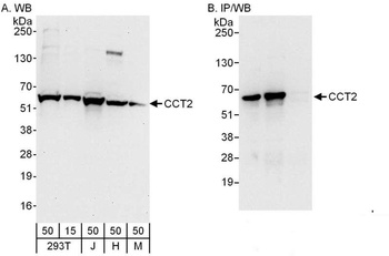 Rabbit CCT2 Antibody