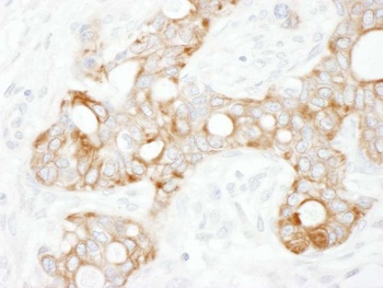 Rabbit TRAF2 Antibody
