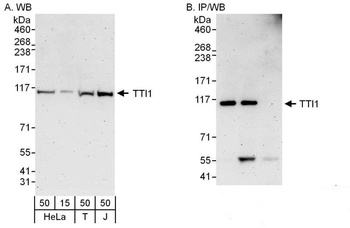 Rabbit TTI1 Antibody