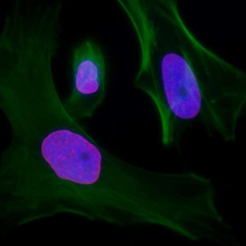 Rabbit Lamin-A Antibody