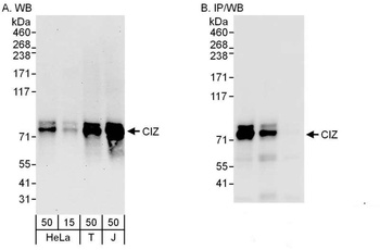 Rabbit CIZ Antibody