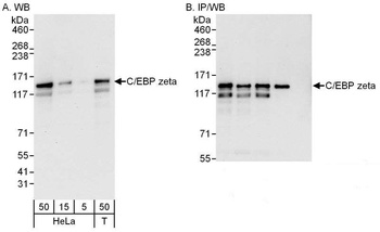Rabbit C/EBP zeta Antibody