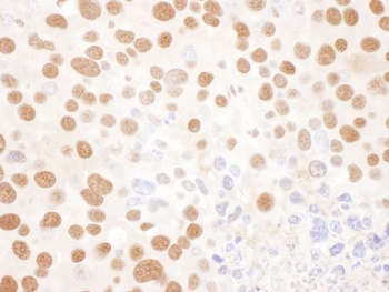 Rabbit NF45 Antibody