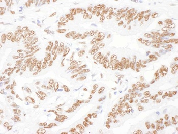Rabbit NF45 Antibody