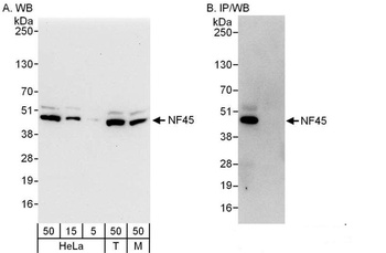 Rabbit NF45 Antibody