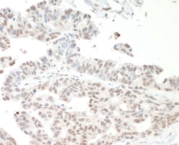 Rabbit NF110 Antibody