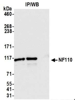 Rabbit NF110 Antibody
