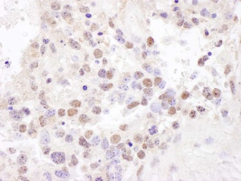 Rabbit NF90/NF110 Antibody